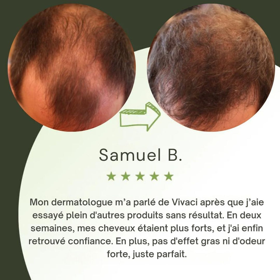 Serum de Croissance Capillaire au Romarin | 100% Naturel & Sans Effets Secondaires  60ml | Adapté pour Homme & Femme