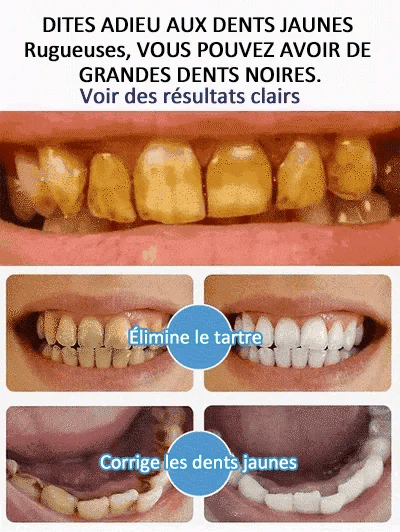 🔥Dentifrice SP-6 pour la gestion de la santé bucco-dentaire, haleine fraîche