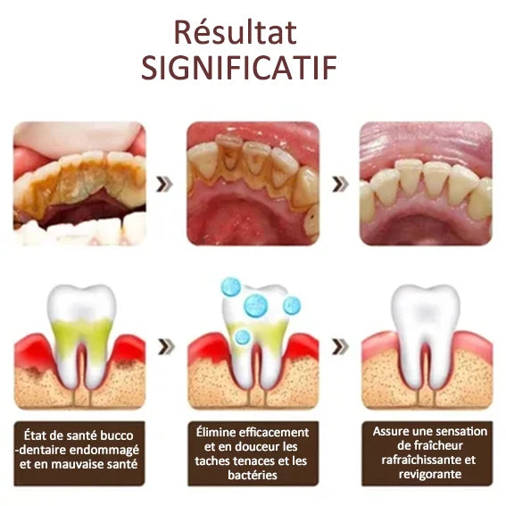 🔥Dentifrice SP-6 pour la gestion de la santé bucco-dentaire, haleine fraîche